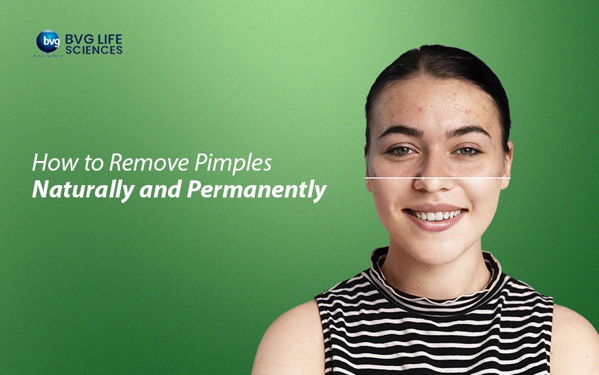 How to Remove Pimples Naturally and Permanently