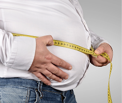 Obesity Management
