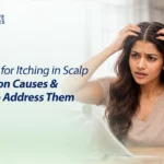 Reason for Itching in Scalp
